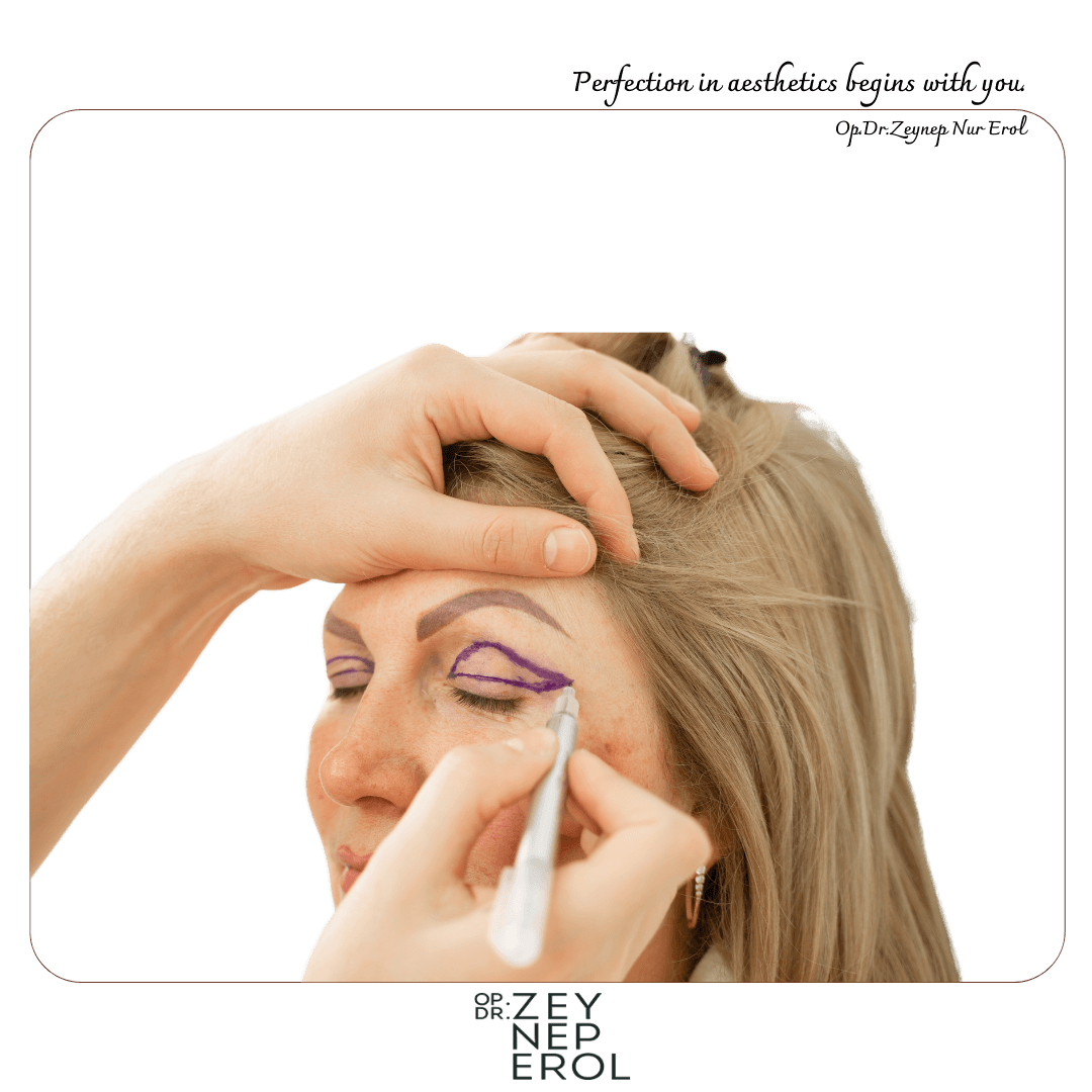 Göz Kapağı Estetiği